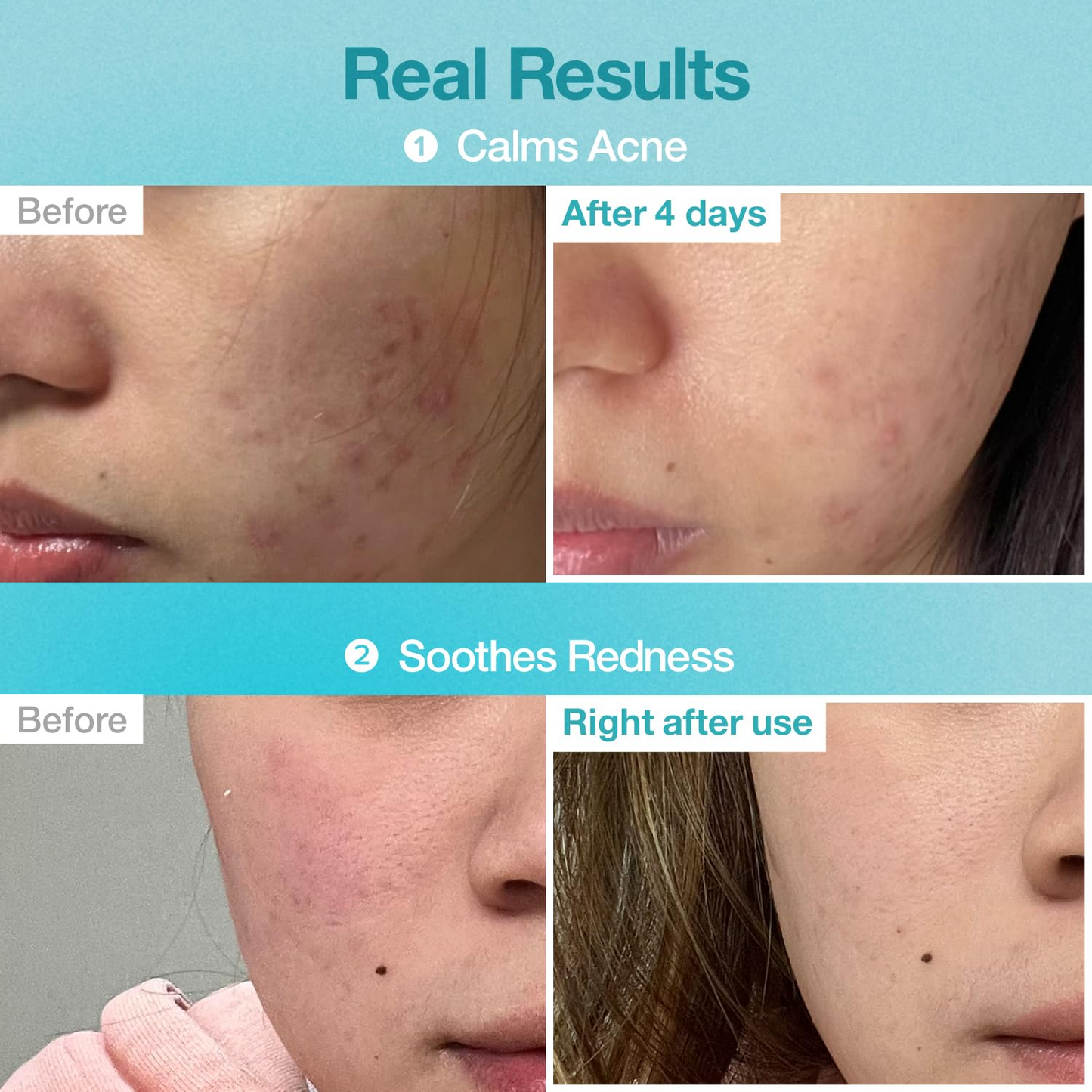 No.1 Pantothenic B5 Hyaluronic Active Clear Mask – 26ml