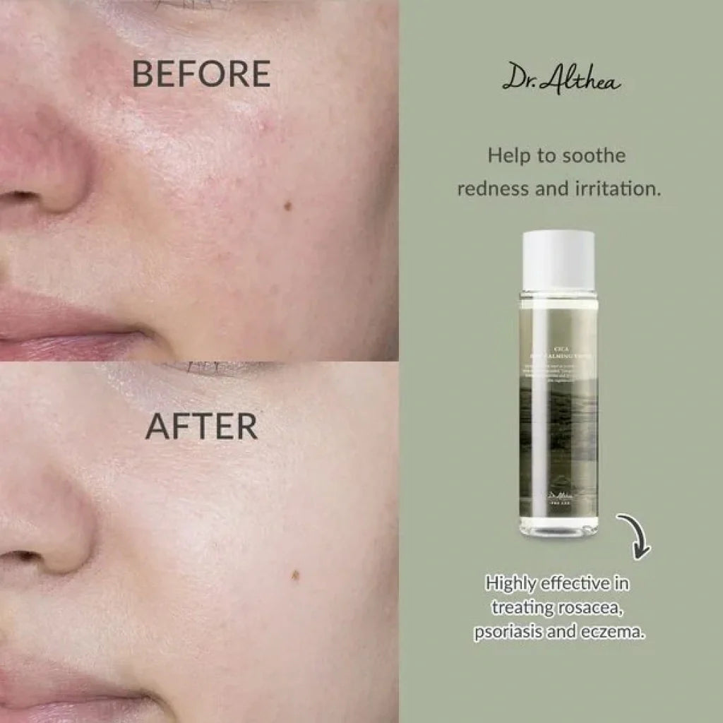 Anastatica Skin Conditioning Toner 250ml