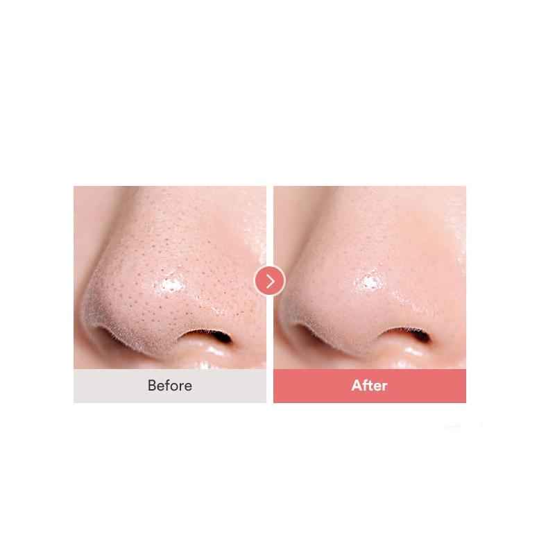 Calamine Pore Control Cleansing Oil 200ml