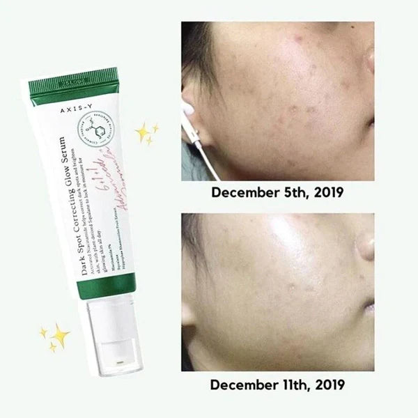 Dark Spot Correcting Glow Serum 50ml