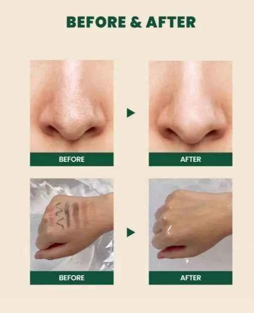 Cleansing Oil : Pine Cica 1% + Probiotics 200ml