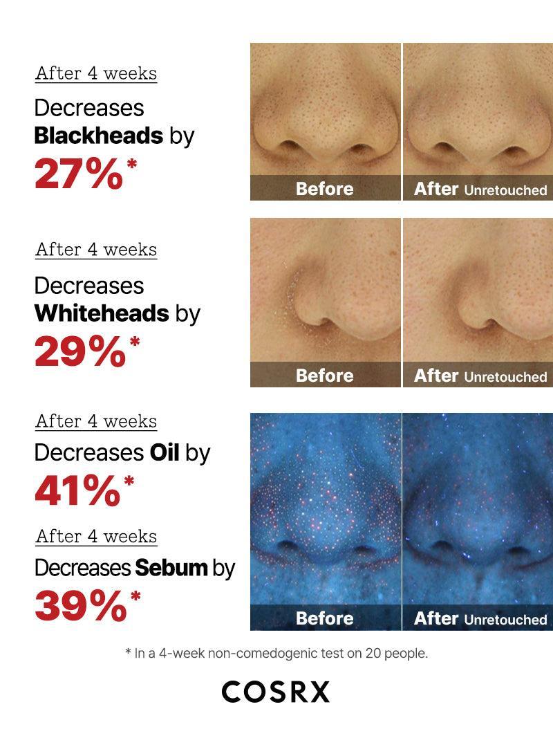 The AHA 2 BHA 2 Blemish Treatment Serum 50gr