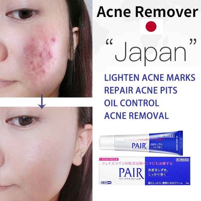 Pair Acne Cream W 24g