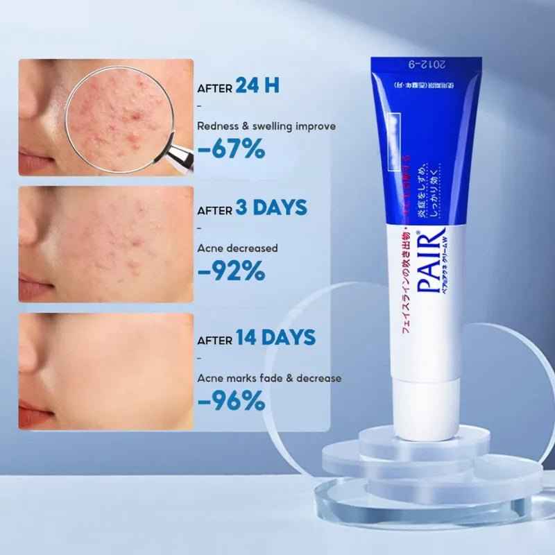 Pair Acne Cream W 24g