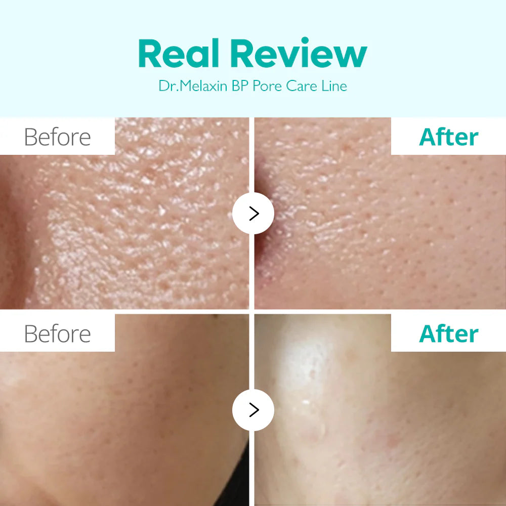 Peel Shot Exfoliant Black Rice Ampoule, 80ml