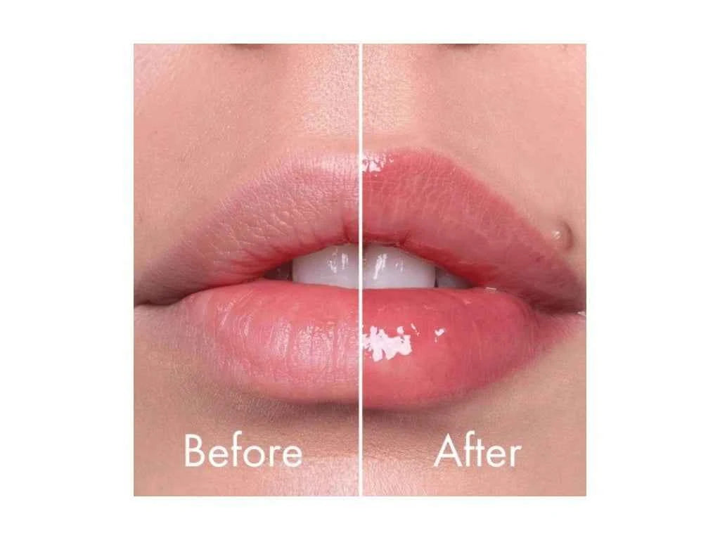 Reedle Shot Lip Plumper Expert 4,3 g