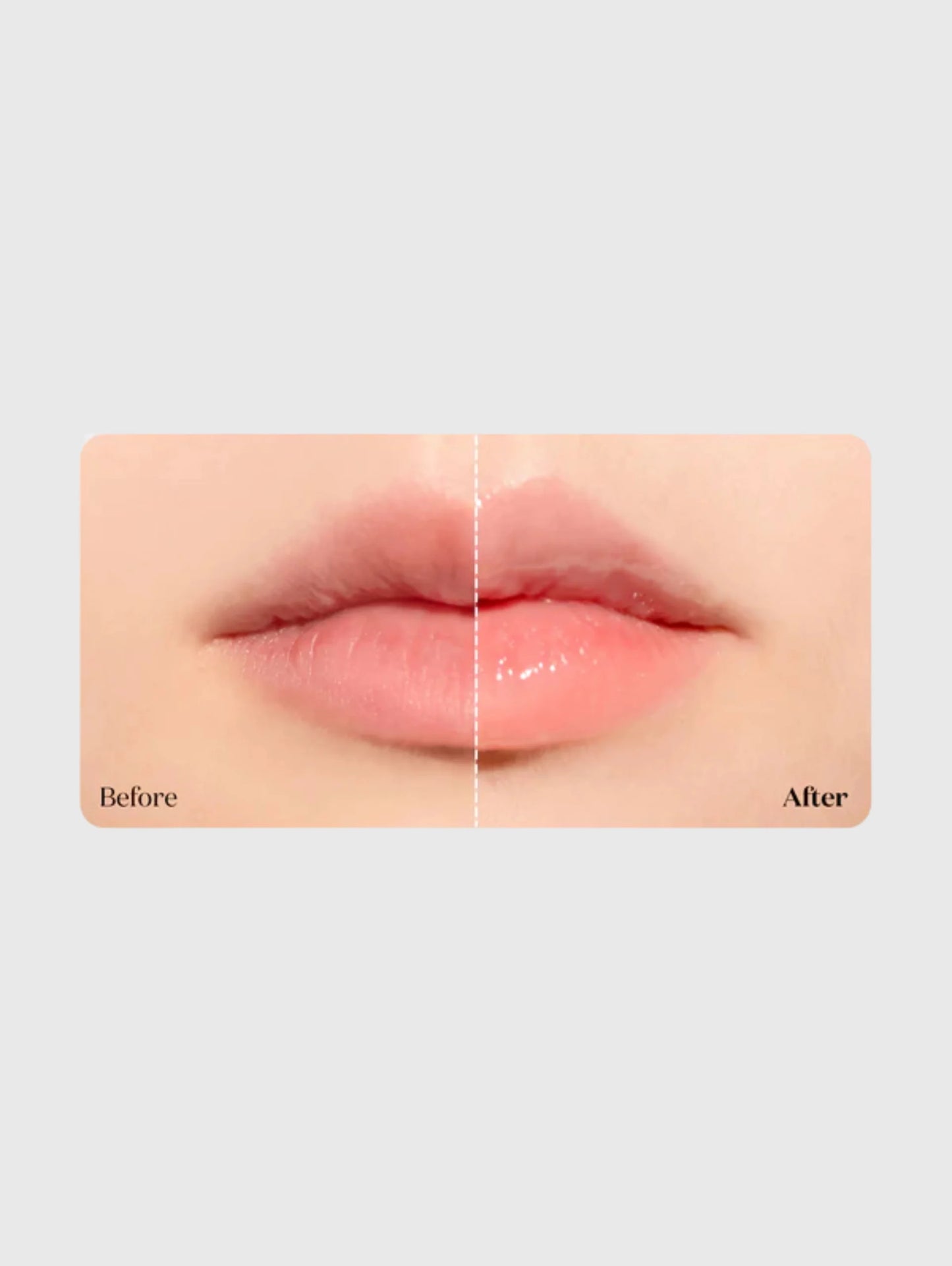 Reedle Shot Lip Plumper Beginner 4,3gr