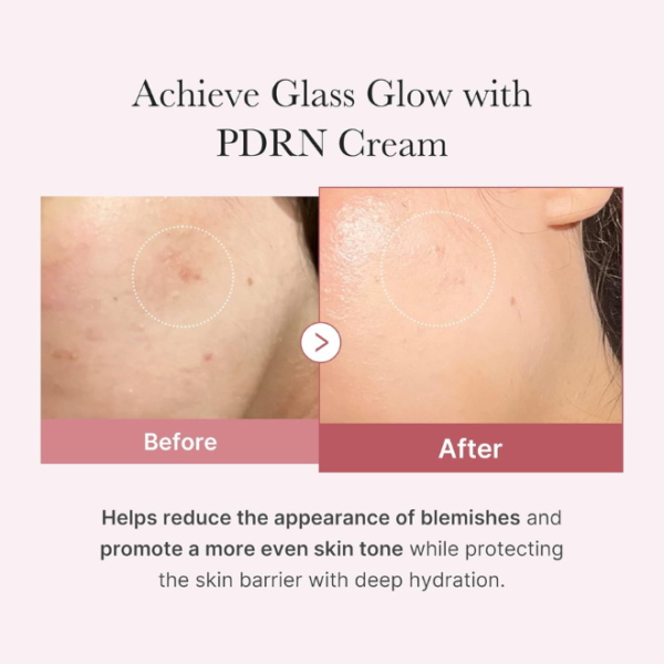 PDRN Pink Hyaluronic Moisturizing Cream 50ml